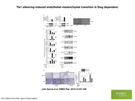 Tie1 silencing‐induced endothelial–mesenchymal transition is Slug dependent. Tie1 silencing‐induced endothelial–mesenchymal transition is Slug dependent.