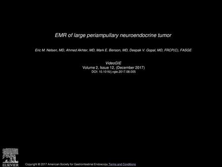 EMR of large periampullary neuroendocrine tumor