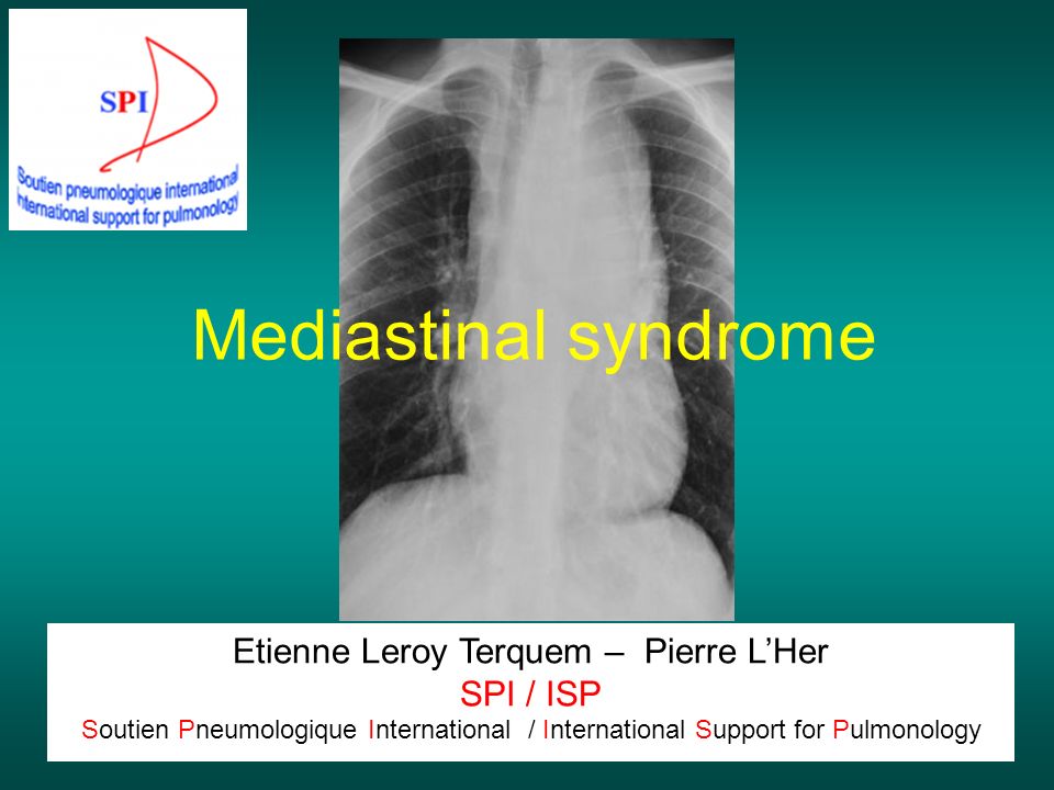 Etienne Leroy Terquem – Pierre L'Her SPI / ISP Soutien Pneumologique  International / International Support for Pulmonology Mediastinal syndrome.  - ppt download