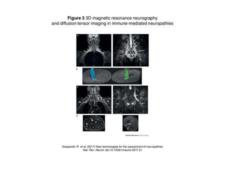 Figure 3 3D magnetic resonance neurography