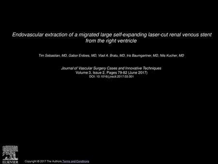 Endovascular extraction of a migrated large self-expanding laser-cut renal venous stent from the right ventricle  Tim Sebastian, MD, Gabor Erdoes, MD,