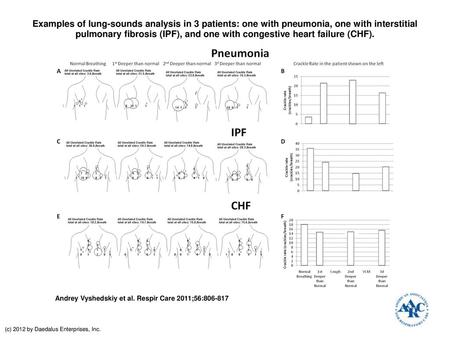 Examples of lung-sounds analysis in 3 patients: one with pneumonia, one with interstitial pulmonary fibrosis (IPF), and one with congestive heart failure.