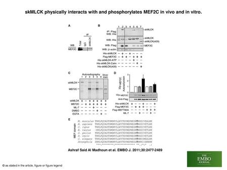 SkMLCK physically interacts with and phosphorylates MEF2C in vivo and in vitro. skMLCK physically interacts with and phosphorylates MEF2C in vivo and in.