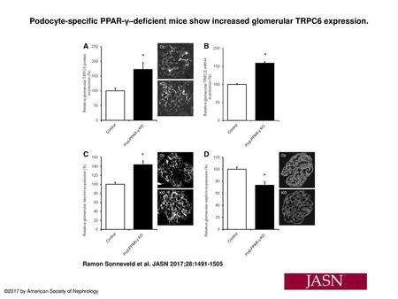 Podocyte-specific PPAR-γ–deficient mice show increased glomerular TRPC6 expression. Podocyte-specific PPAR-γ–deficient mice show increased glomerular TRPC6.