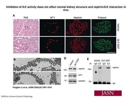 Inhibition of ILK activity does not affect normal kidney structure and nephrin/ILK interaction in vivo. Inhibition of ILK activity does not affect normal.