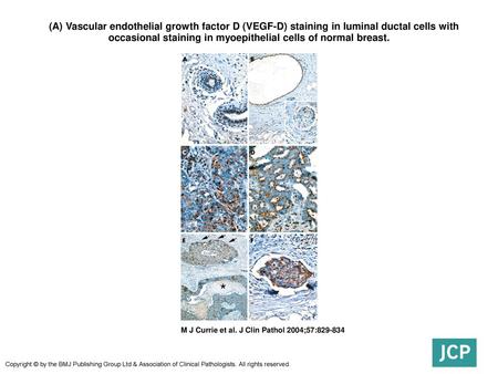  (A) Vascular endothelial growth factor D (VEGF-D) staining in luminal ductal cells with occasional staining in myoepithelial cells of normal breast.  (A)