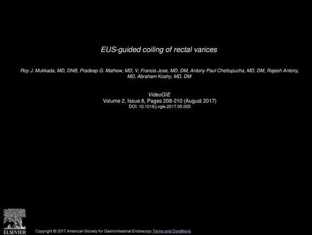 EUS-guided coiling of rectal varices