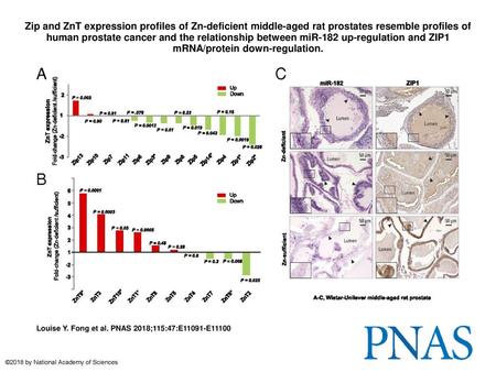 Zip and ZnT expression profiles of Zn-deficient middle-aged rat prostates resemble profiles of human prostate cancer and the relationship between miR-182.