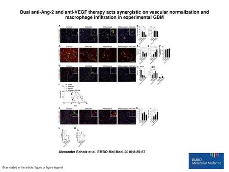 Dual anti‐Ang‐2 and anti‐VEGF therapy acts synergistic on vascular normalization and macrophage infiltration in experimental GBM Dual anti‐Ang‐2 and anti‐VEGF.