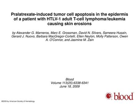 Pralatrexate-induced tumor cell apoptosis in the epidermis of a patient with HTLV-1 adult T-cell lymphoma/leukemia causing skin erosions by Alexander G.