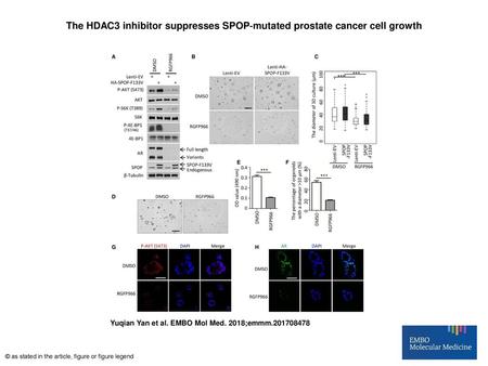 The HDAC3 inhibitor suppresses SPOP‐mutated prostate cancer cell growth The HDAC3 inhibitor suppresses SPOP‐mutated prostate cancer cell growth A22Rv1.