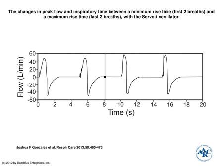 The changes in peak flow and inspiratory time between a minimum rise time (first 2 breaths) and a maximum rise time (last 2 breaths), with the Servo-i.