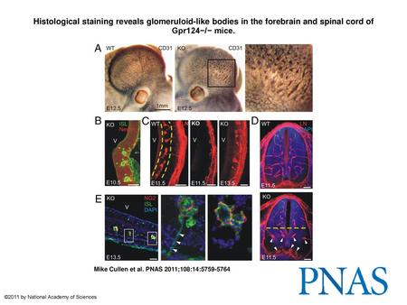 Histological staining reveals glomeruloid-like bodies in the forebrain and spinal cord of Gpr124−/− mice. Histological staining reveals glomeruloid-like.