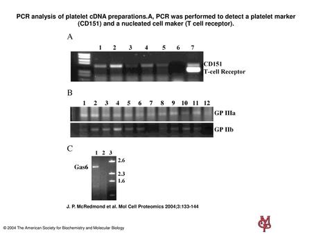 PCR analysis of platelet cDNA preparations
