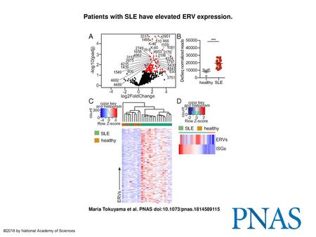 Patients with SLE have elevated ERV expression.