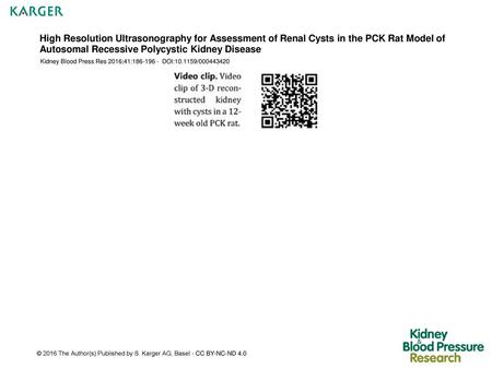 High Resolution Ultrasonography for Assessment of Renal Cysts in the PCK Rat Model of Autosomal Recessive Polycystic Kidney Disease Kidney Blood Press.