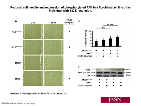 Reduced cell motility and expression of phosphorylated FAK in a fibroblast cell line of an individual with T3257I mutation. Reduced cell motility and expression.