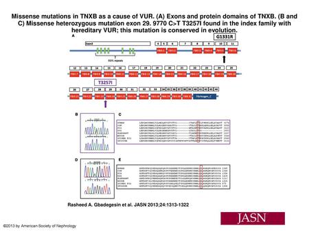 Missense mutations in TNXB as a cause of VUR