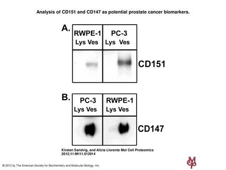 Analysis of CD151 and CD147 as potential prostate cancer biomarkers.