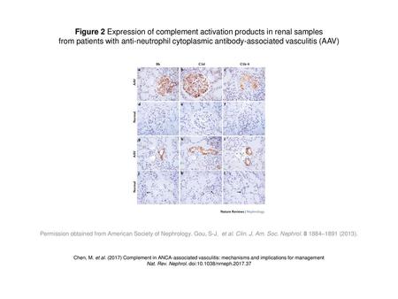 Figure 2 Expression of complement activation products in renal samples