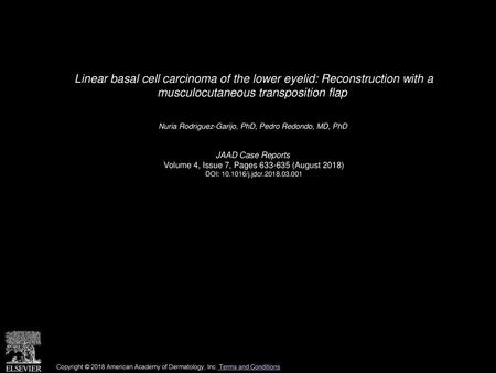 Linear basal cell carcinoma of the lower eyelid: Reconstruction with a musculocutaneous transposition flap  Nuria Rodriguez-Garijo, PhD, Pedro Redondo,