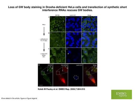 Loss of GW body staining in Drosha‐deficient HeLa cells and transfection of synthetic short interference RNAs rescues GW bodies. Loss of GW body staining.