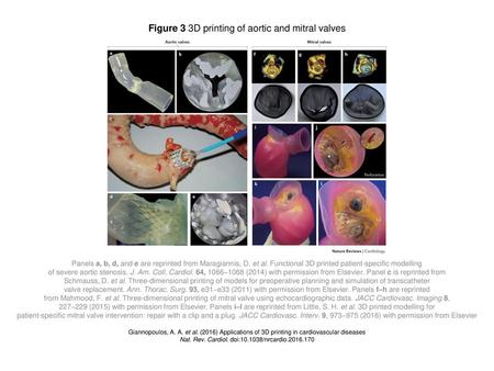 Figure 3 3D printing of aortic and mitral valves