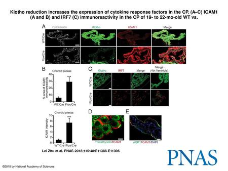 Klotho reduction increases the expression of cytokine response factors in the CP. (A–C) ICAM1 (A and B) and IRF7 (C) immunoreactivity in the CP of 19-