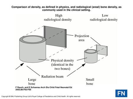 Comparison of density, as defined in physics, and radiological (areal) bone density, as commonly used in the clinical setting. Comparison of density, as.