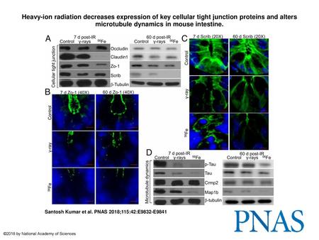 Heavy-ion radiation decreases expression of key cellular tight junction proteins and alters microtubule dynamics in mouse intestine. Heavy-ion radiation.