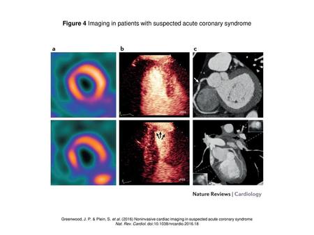 Figure 4 Imaging in patients with suspected acute coronary syndrome
