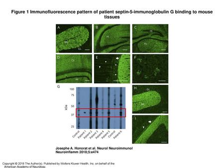 Figure 1 Immunofluorescence pattern of patient septin-5-immunoglobulin G binding to mouse tissues Immunofluorescence pattern of patient septin-5-immunoglobulin.