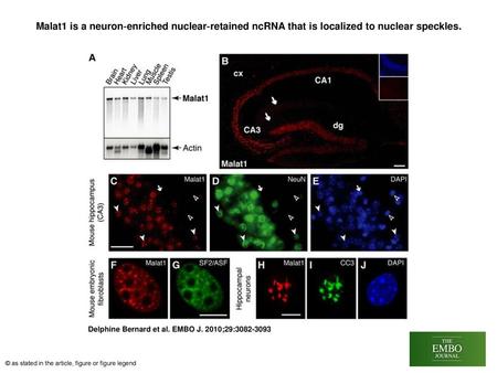 Malat1 is a neuron‐enriched nuclear‐retained ncRNA that is localized to nuclear speckles. Malat1 is a neuron‐enriched nuclear‐retained ncRNA that is localized.