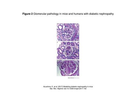 Figure 2 Glomerular pathology in mice and humans with diabetic nephropathy Figure 2 | Glomerular pathology in mice and humans with diabetic nephropathy.