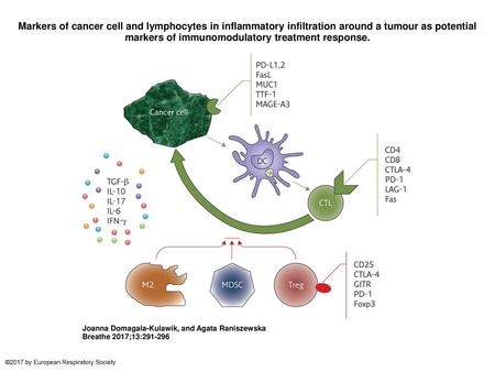 Markers of cancer cell and lymphocytes in inflammatory infiltration around a tumour as potential markers of immunomodulatory treatment response. Markers.