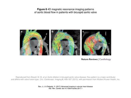 Figure 8 4D magnetic resonance imaging patterns