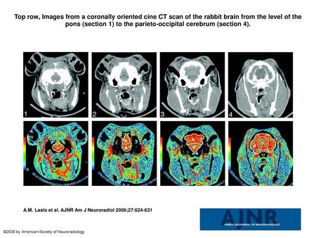 Top row, Images from a coronally oriented cine CT scan of the rabbit brain from the level of the pons (section 1) to the parieto-occipital cerebrum (section.