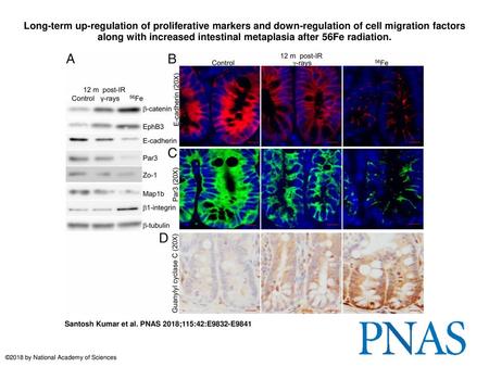 Long-term up-regulation of proliferative markers and down-regulation of cell migration factors along with increased intestinal metaplasia after 56Fe radiation.