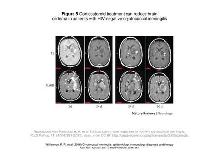 Figure 5 Corticosteroid treatment can reduce brain