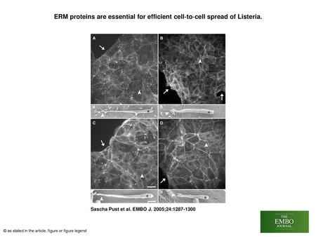 ERM proteins are essential for efficient cell‐to‐cell spread of Listeria. ERM proteins are essential for efficient cell‐to‐cell spread of Listeria. (A–D)