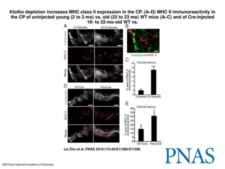 Klotho depletion increases MHC class II expression in the CP