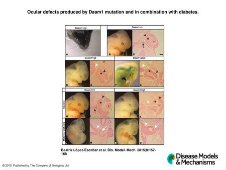 Ocular defects produced by Daam1 mutation and in combination with diabetes. Ocular defects produced by Daam1 mutation and in combination with diabetes.