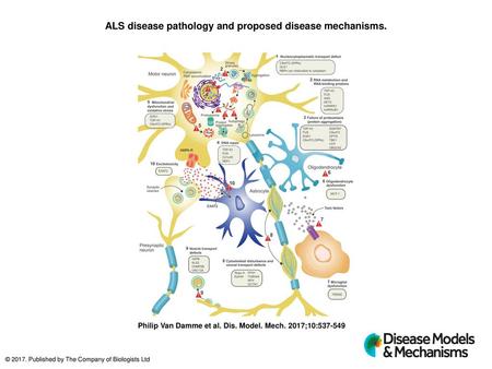 ALS disease pathology and proposed disease mechanisms.