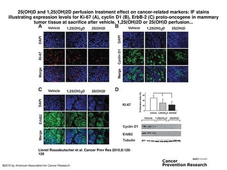 25(OH)D and 1,25(OH)2D perfusion treatment effect on cancer-related markers: IF stains illustrating expression levels for Ki-67 (A), cyclin D1 (B), ErbB-2.