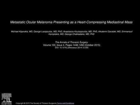 Metastatic Ocular Melanoma Presenting as a Heart-Compressing Mediastinal Mass  Michael Kiparakis, MD, George Lazopoulos, MD, PhD, Anastasios Koutsopoulos,