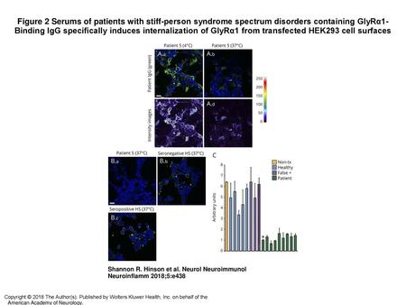 Figure 2 Serums of patients with stiff-person syndrome spectrum disorders containing GlyRα1-Binding IgG specifically induces internalization of GlyRα1.