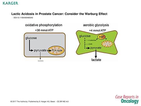 Lactic Acidosis in Prostate Cancer: Consider the Warburg Effect