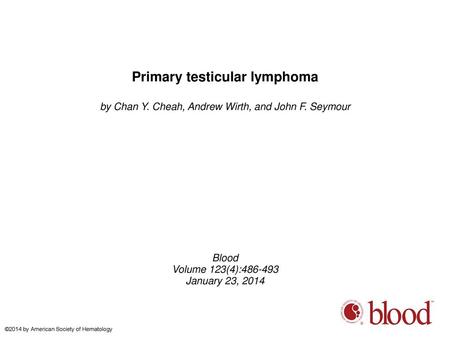 Primary testicular lymphoma