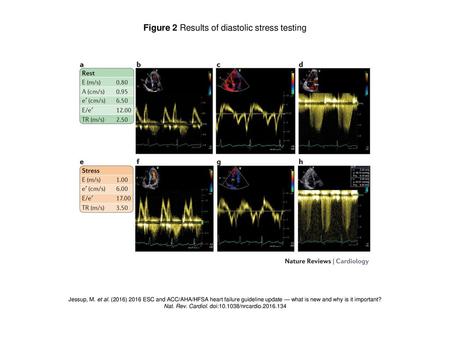 Figure 2 Results of diastolic stress testing