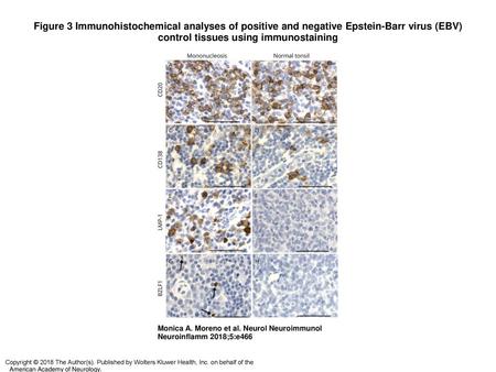 Figure 3 Immunohistochemical analyses of positive and negative Epstein-Barr virus (EBV) control tissues using immunostaining Immunohistochemical analyses.